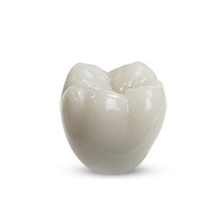 Rodin® RapidCeram